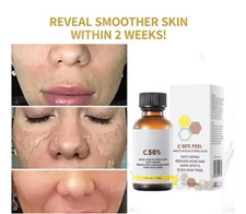 50% MALIC ACID & CITRIC ACID SKIN PEEL SERUM. MILDER THAN GLYCOLIC & LACTIC ACID