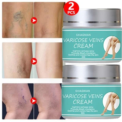SXIAGNIAN 2PACK Varicose and Spider Veins Smoothing Natural Treatment Cream for Tired Legs