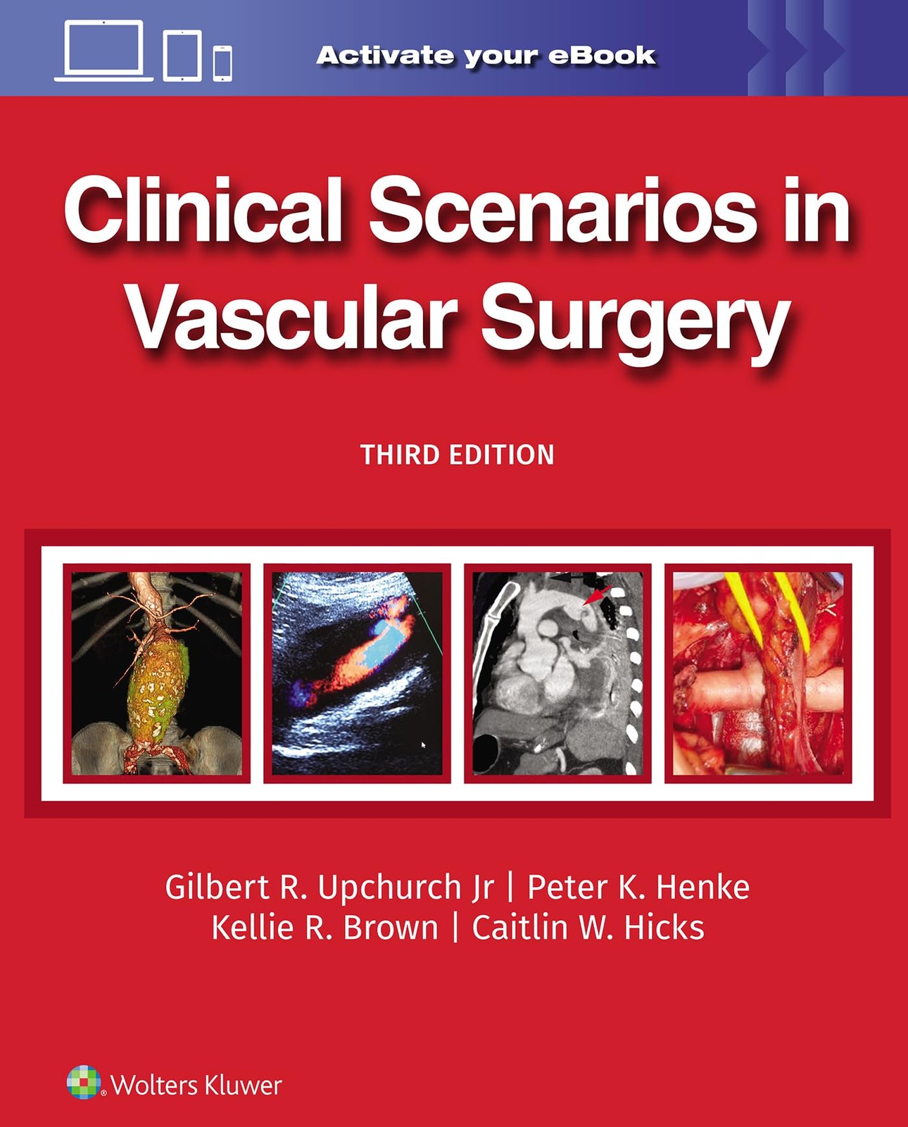 Clinical Scenarios in Vascular Surgery. UPCHURCH, UPCHURCH, HENKE, Brown, MD,**