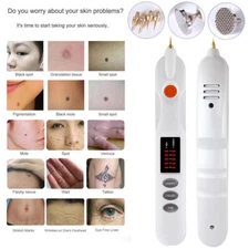 White Plasma Laser Beauty Machine Dark Spot And Pigment Remove Tool(Wired model)