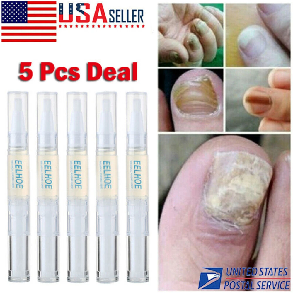 Top 131+ fungi nail side effects songngunhatanh.edu.vn