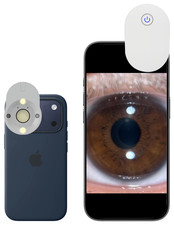 Smartphone Iridology Lens Adaptor S3 Iridology Camera, Iriscope, Sclerology