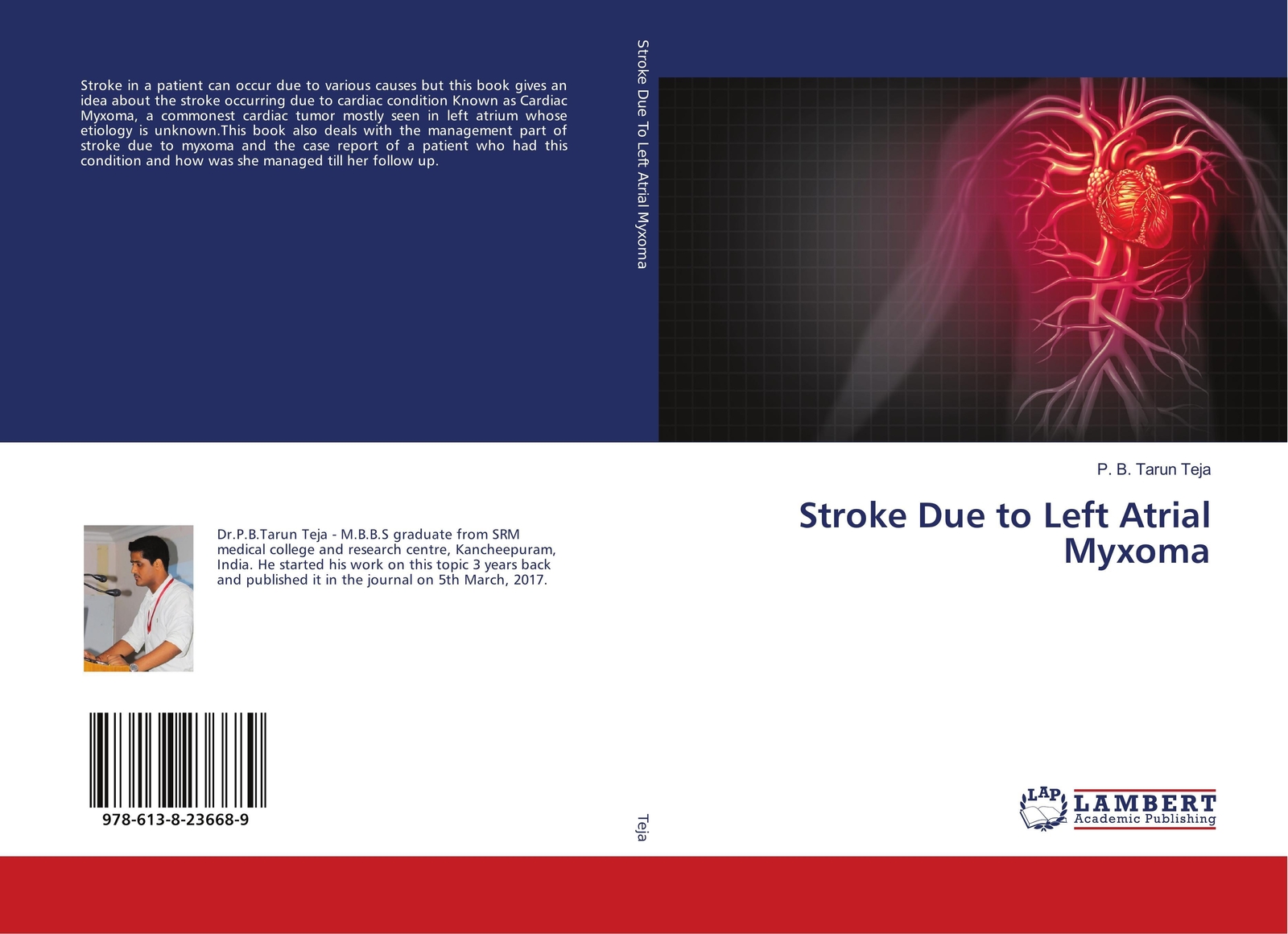 Thumbnail - Stroke Due To Left Atrial Myxoma P. B. Tarun Teja Taschenbuch