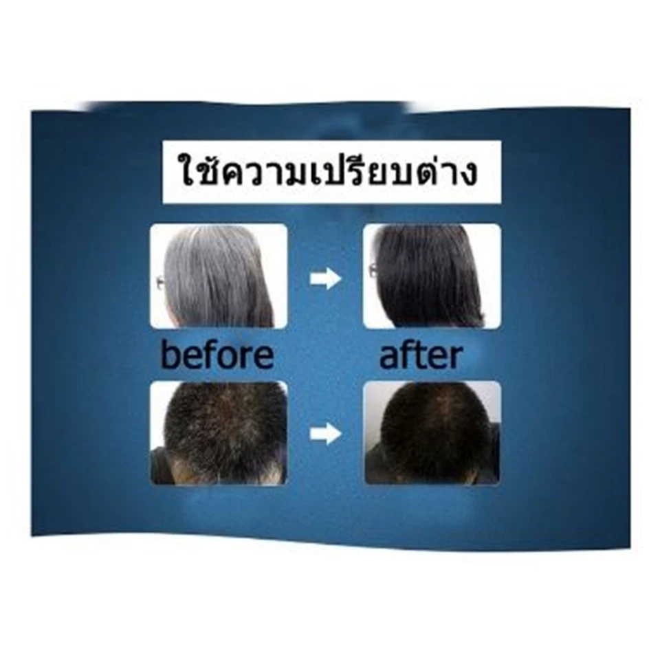 8x Natural Ultronic Hair Dark Black Grey Young Restoria Cream Restore Men Women - Image 2 of 4