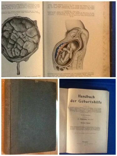 Libri vecchi dal 1900 al 1919 copertine rigide, tema medicina in tedesco
