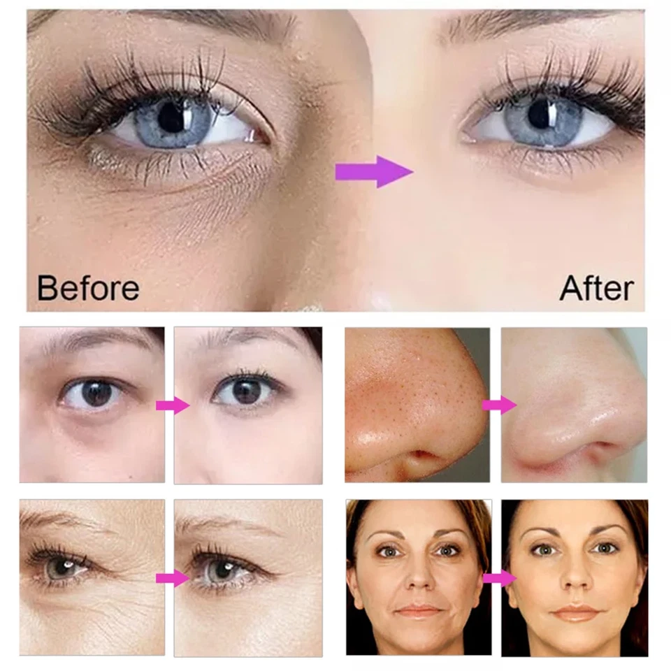 Portable Dcool Cryo Cool Electroporation EMS Mesotherapy Machine Face Skin Lift - image 4 of 4