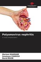 Polyomavirus Nephritis In Renal Transplantation Meriam Khadhar (U. A.) Buch 2023