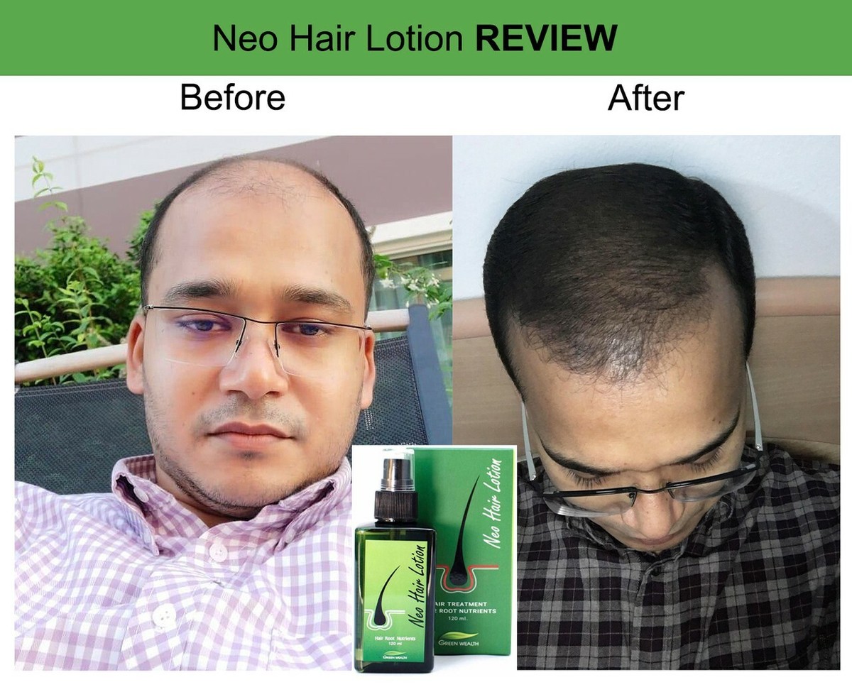 VARON MASTER'S BLEND 乳液 120ml 120ml Neo hair lotion 100% Natural, Original Authentic, MFG