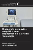 El Papel De La Sinovitis EcográFica En El DiagnóStico De La Artritis Reumatoide