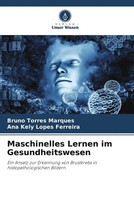 Bruno Torres Marques (U. A.) | Maschinelles Lernen Im Gesundheitswesen | Buch
