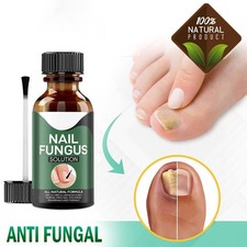 ANTI FUNGAL TREATMENT EXTRA STRENGTH TOENAIL FUNGUS ATHLETES FOOT FUNGI NAIL