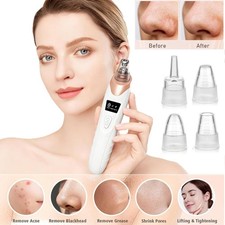 2026 Blackhead Remover Pore Vacuum,Facial Pore Cleaner-5 Suction Power,5 Probes