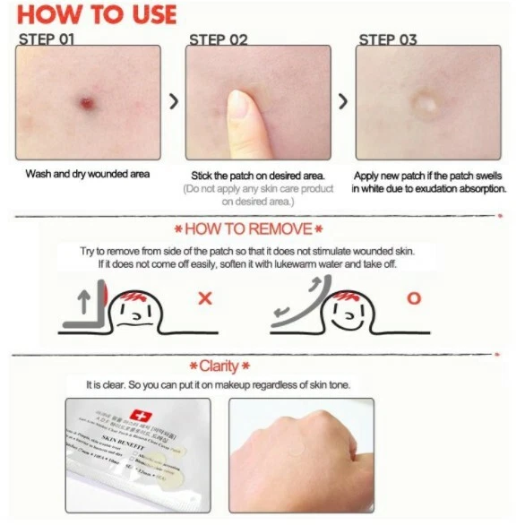 NEW COSRX Acne Pimple Master Patch 6 sheets X 24 Patches Reduce Acne Spots - Image 2 of 4