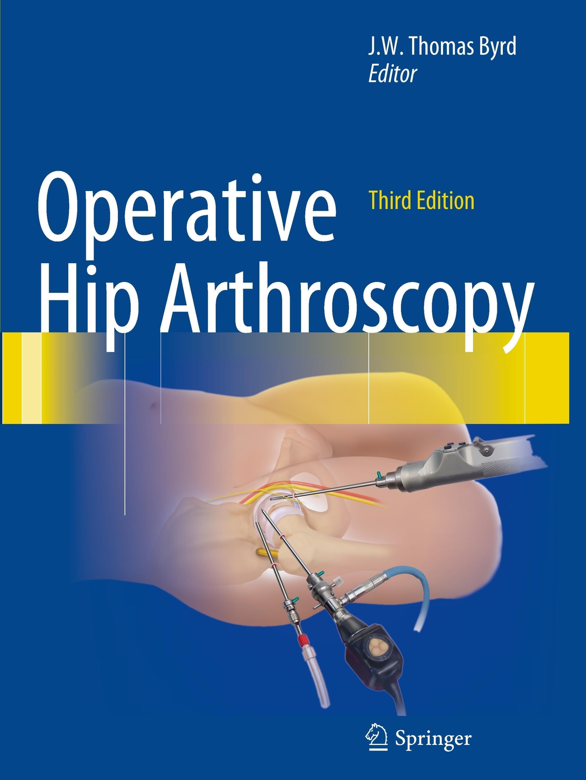 Thumbnail - Operative Hip Arthroscopy J. W. Thomas Byrd Taschenbuch Paperback Xxii