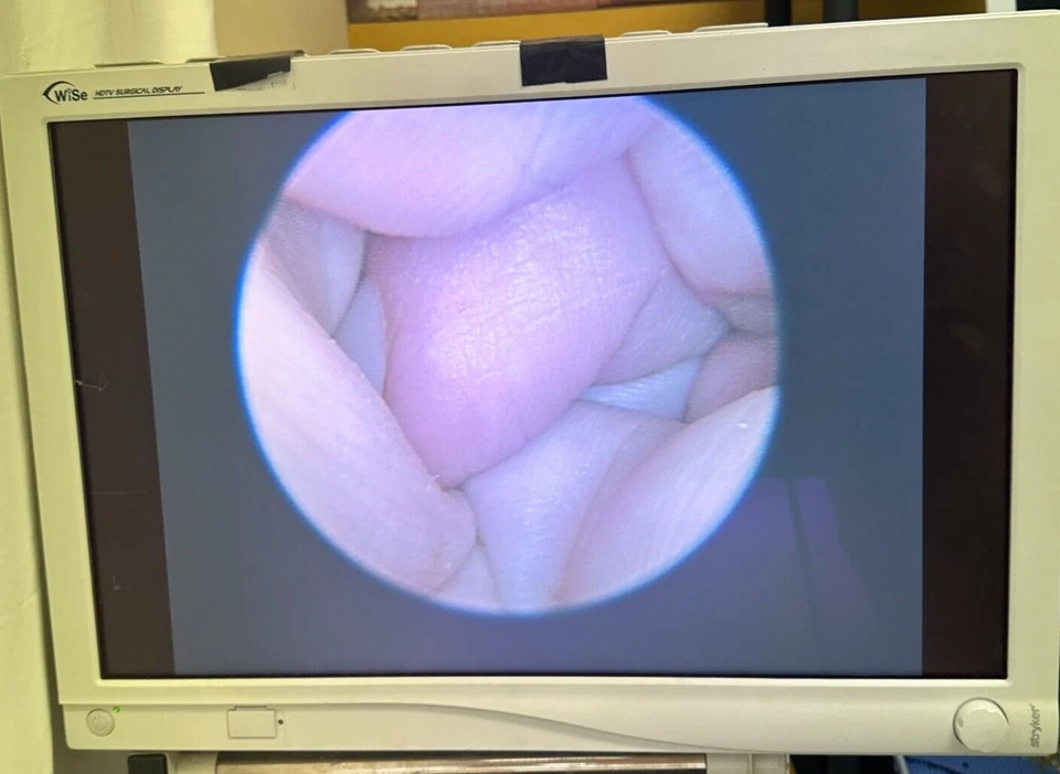 R. Wolf 8914.31 12 毫米 x 10° 偏移操作性腹腔镜带阀腹腔镜检查 — 第 2/4 张图片