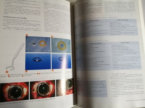 PATHOLOGIE DU VITRÉ par Gérard Brasseur MASSON Ophtalmologie yeux oeil maladies - Picture 9 of 10