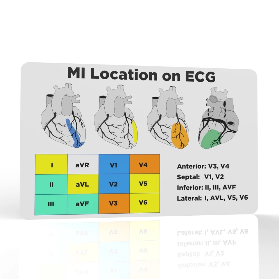 THE PRINT NINJA Stemi / MI Reference Card Student Paramedic Nurse Doctor Medic