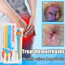 42.5g Hemorrhoids Remove Ointment Herbal Cream Relief Piles Pain Reduce Itching