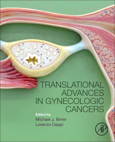Translational Advances in Gynecologic Cancers Birrer Ceppi Paperback