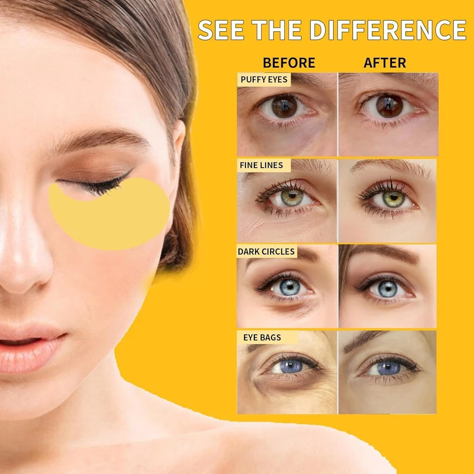Máscaras de ojos de oro 24K para ojeras e hinchazón 70 piezas, parches debajo de los ojos para P Foto 4 de 4