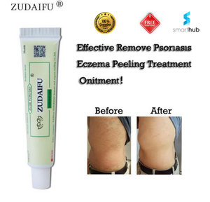 Natural Cream Best For Skin Rash Disease Care Itching ...