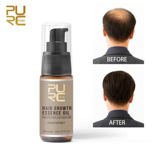 Hair Growth Concentrate Oil 3 Bottles 3 Months Supply Hair Loss