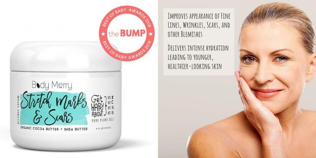 body merry stretch marks & scars