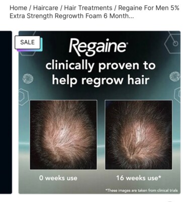 regaine foam for men