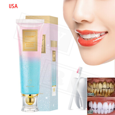 Niacinamide Whitening Toothpaste Natural Niacinamide Toothpaste Teeth Whitening