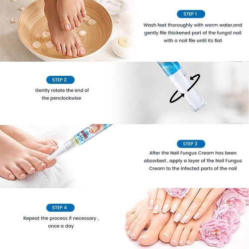 New Sumifun Nail Fungus Treatment 4ml Revive Pen Soothing Nail R9P9 USA L0Y7 - 第 9/11 張圖片
