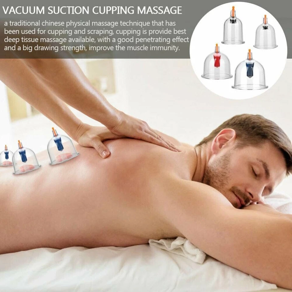 12 Cups Chinese Cupping Set Vacuum Suction Cups for Pain Relief Physical Therapy - Image 2 of 4
