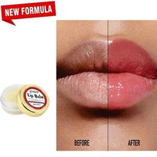 Lip Lightening Cream for Dark Lips | Lip Lightener for Smokers and Non-Smokers
