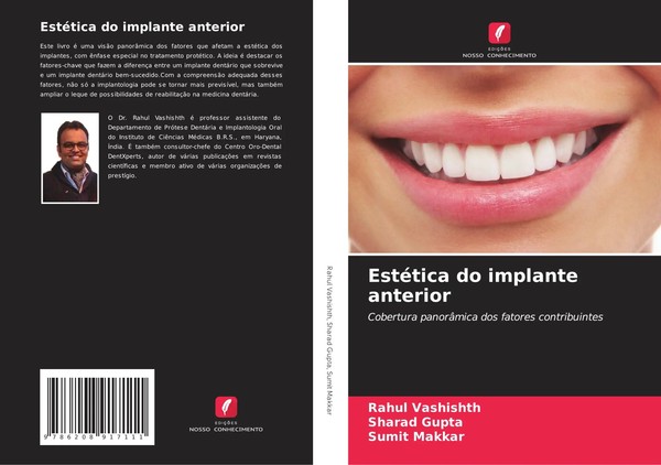 Rahul Vashishth (U. A.) | EstéTica Do Implante Anterior | Taschenbuch (2025)-image