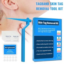 Micro Skin Tag Remover Tool Kit Rubber Bands for Wart Acne Skin Tags Removal Set