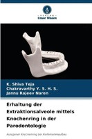 Erhaltung Der Extraktionsalveole Mittels Knochenring In Der Parodontologie Buch