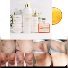 Victoria Solution Double Glutathione Inject Bleaching Set