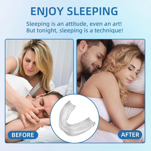 2PCS Anti-Snoring Mouth Guard Anti-Snoring, Snoring Solution for Men&Women Sleep - Picture 6 of 13