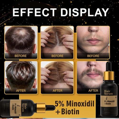 5% Minoxidil+Biotin for Hair Growth Serum & Hair loss regrowth for Men Women - Picture 9 of 14