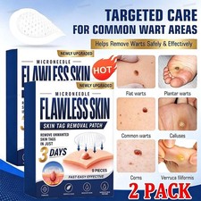 Skin Tag Remover Patches Microneedle Hydrocolloid Patches, Skin Repair for Tags
