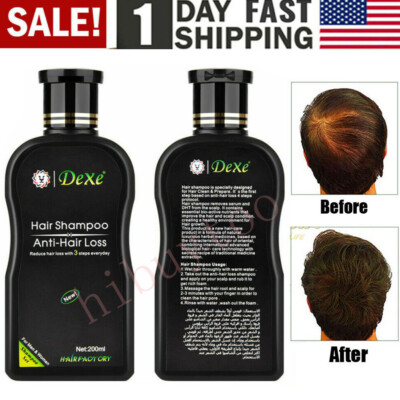 Dexe Hair Shampoo Anti hair Loss Chinese Herbal Hair Growth For Men &Women 200ml