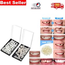 Gentle Instant Dental Repair Kit - 70 Pcs Front & 50 Pcs Back Parts for Comfort