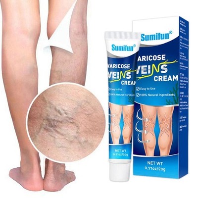 1* 20g Treatment Legs Varicose Veins Cream Herbal Ointment Fading DE G6Z1