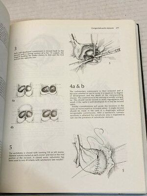 Rob & Smith's Operative Surgery Thoracic & Cardiac Surgery 2