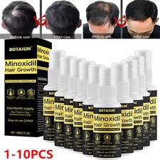 Minoxidil 5 Extra Strength Men Hair Regrowth Solution Treatment 10 Month Supply