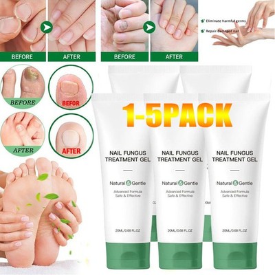 5X Nutraboost Nail Fungus Treatment Gel, Nail Fungus, Fungus Cream US (-20%OFF)