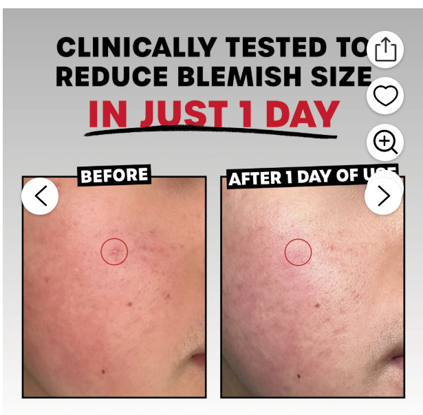 Thayers Rapid Sulfur Acne Treatment, Soothing & Non-Stripping Skin Care, 0.5 fl