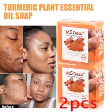 Tumeric Soap Skin Whitening Dark Spots lightening Acne Brightening Turmeric