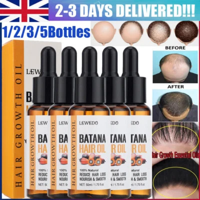 LEWEDO,SAUVASINE Batana Oil Conditioner for Hair Growth, Organic Natural, Promotes Hair Wellness