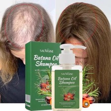 100ml Batana Oil Shampoo with Rosemary Extract for Hair Growth,Reduce Hair Loss