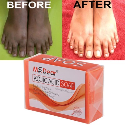 Kojic Acid Soap Dark Skin Whitening Bleaching Lightening Brightening Face & Body